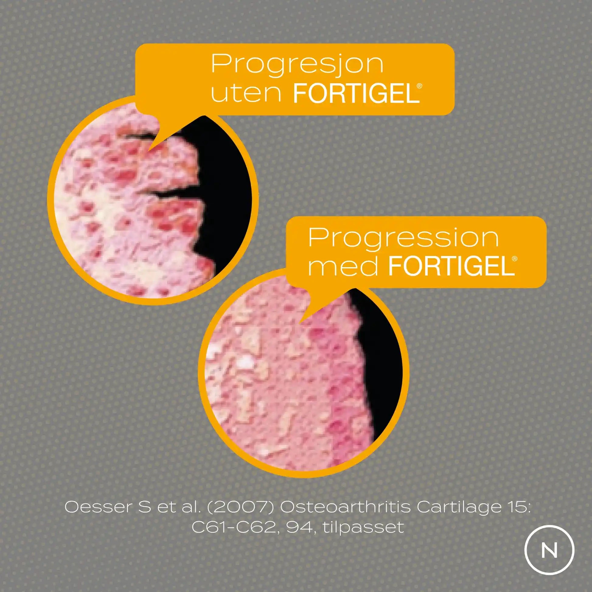 fortigel progresjon