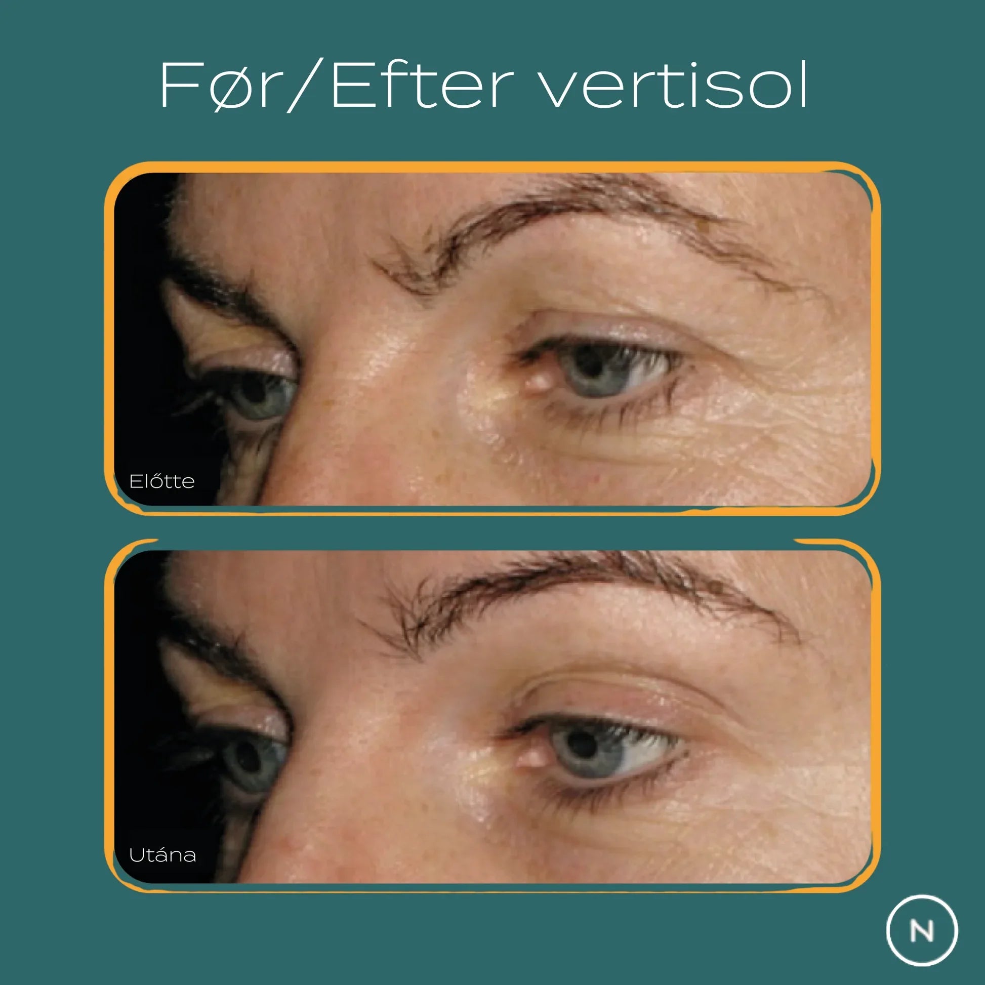 verisol for og efter