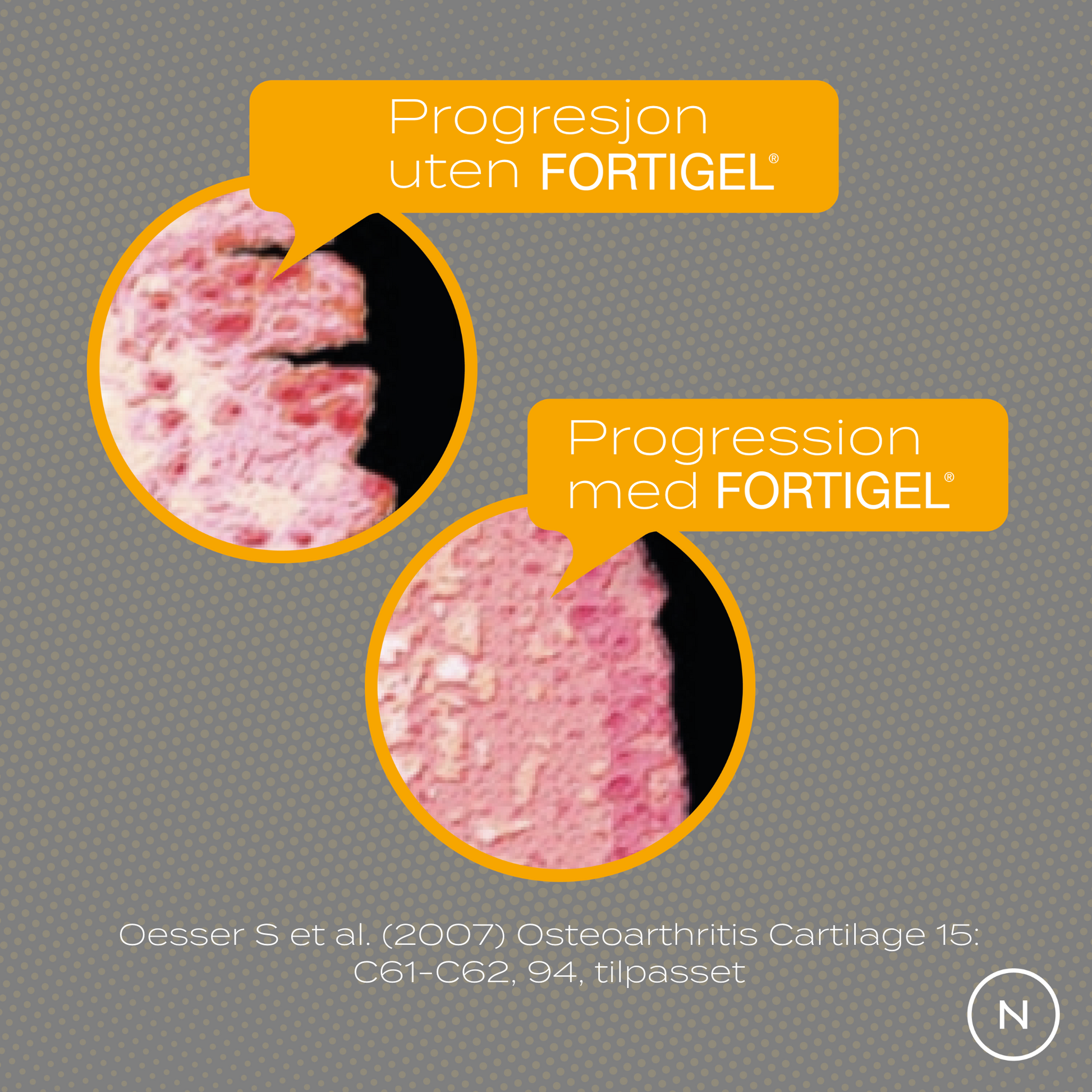 progresjon uten och med fortigel